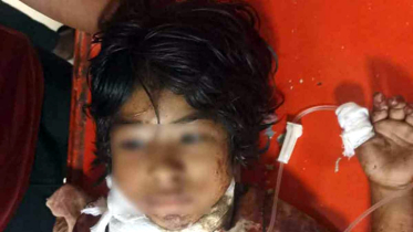 ইকোপার্ক থেকে গলাকাটা অবস্থায় উদ্ধার করা সেই শিশুটি মারা গেছে ইকোপার্ক থেকে গলাকাটা অবস্থায় উদ্ধার করা সেই শিশুটি মারা গেছে