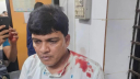 এনসিপি নেতা দেলোয়ার হোসেনকে কুপিয়ে জখম এনসিপি নেতা দেলোয়ার হোসেনকে কুপিয়ে জখম